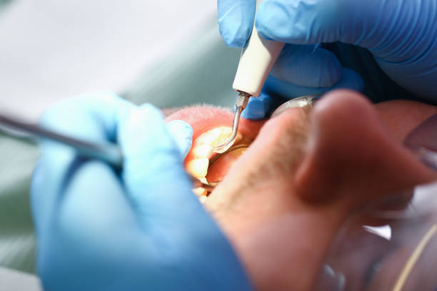Best Broken or Cracked Tooth Emergency Dentist in Black Mountain, NC