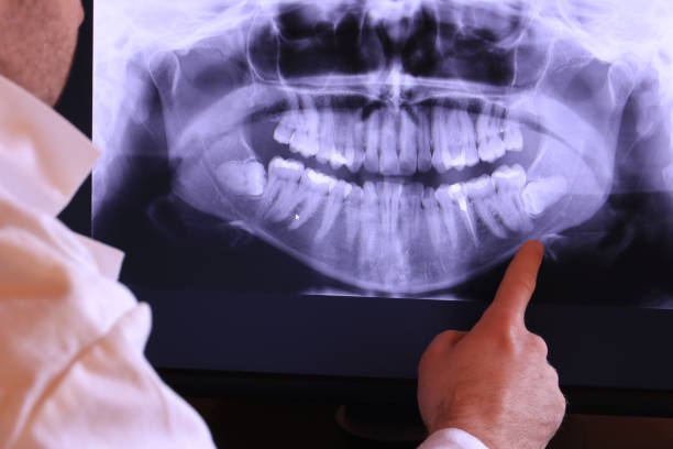 Best Emergency Dentist for Special Needs Patients in Black Mountain, NC