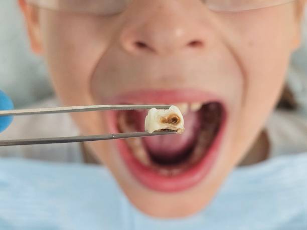 Best Weekend Emergency Dentist in Black Mountain, NC